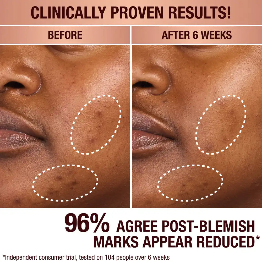 DARK SPOT CORRECTING RADIANCE RECOVERY SERUM 10 ML