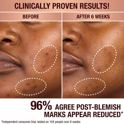 DARK SPOT CORRECTING RADIANCE RECOVERY SERUM 10 ML